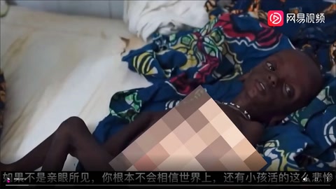 烏干達兒童最真實<em>的</em>生活<em>狀態</em>