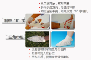 <em>紅十字</em><em>應急</em><em>救護</em><em>技能</em><em>系列講座</em>——<em>包扎</em>——手腳<em>包扎</em><em>方法</em>