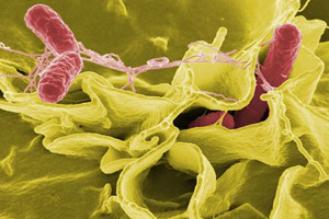 腸桿菌<em>科</em>：醫學微生物<em>細菌學</em>中<em>的</em>代表章節