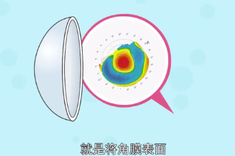 什么是角膜<em>地形圖</em>