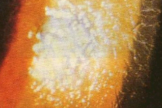 隱形眼鏡常見沉淀物—生物膜沉淀