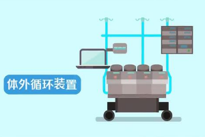 什么是人工心肺機？